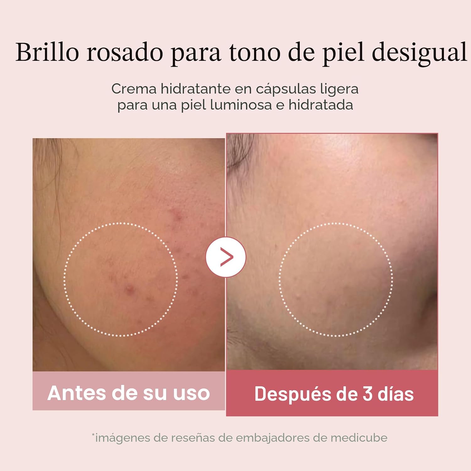 medicube crema cápsula con salmón adn pdrn colágeno rosa | crema hidratante ligera con pdrn, niacinamida para tono y textura desigual de la piel, hidratación brillante medicube crema cápsula con salmón adn pdrn colágeno rosa | crema hidratante ligera con pdrn, niacinamida para tono y textura desigual de la piel, hidratación brillante